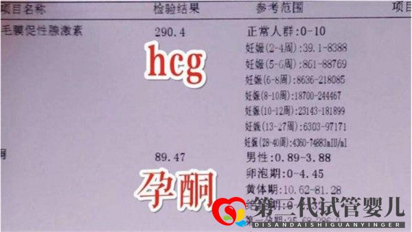 通過試管嬰兒移植后多久可以驗(yàn)孕驗(yàn)孕成功后多久可以測胎心(圖1) 通過試管嬰兒移植后多久可以驗(yàn)孕驗(yàn)孕成功后多久可以測胎心(圖1)