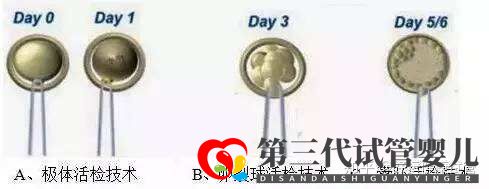 好運健康三代試管知男女的必經(jīng)之路—胚胎活檢術(shù)(圖1)