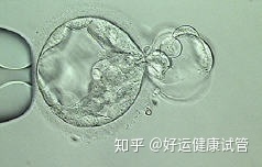好運健康三代試管知男女的必經(jīng)之路—胚胎活檢術(shù)(圖7)