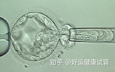 好運健康三代試管知男女的必經(jīng)之路—胚胎活檢術(shù)(圖9)
