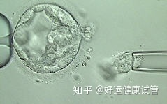 好運健康三代試管知男女的必經(jīng)之路—胚胎活檢術(shù)(圖11)