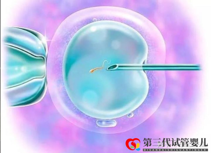 通俗易懂的一、二、三代試管嬰兒解說,及三代試管能...(圖4)