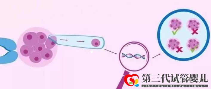 通俗易懂的一、二、三代試管嬰兒解說,及三代試管能...(圖7)