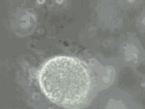 精子碎片率高可以做三代試管嬰兒嗎？(圖1)