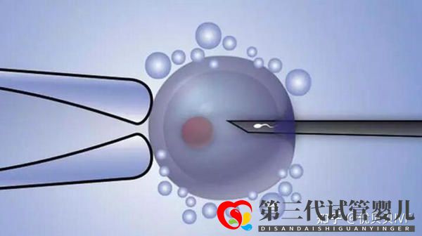國(guó)內(nèi)的三代試管醫(yī)院都有哪些第一梯隊(duì)了解下(圖3) 國(guó)內(nèi)的三代試管醫(yī)院都有哪些第一梯隊(duì)了解下(圖3)