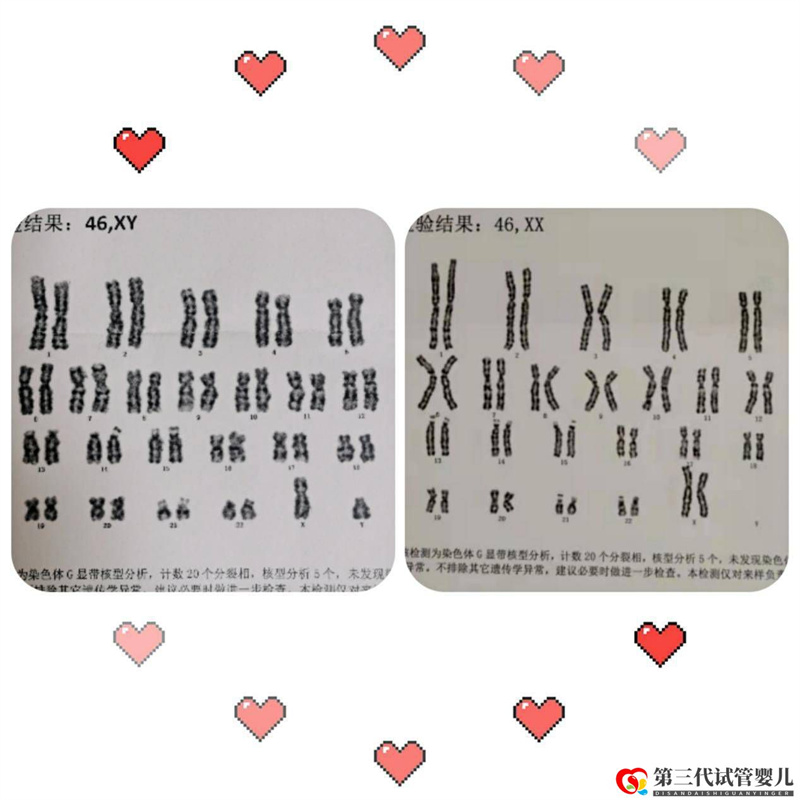 為什么父母染色體正常，胚胎染色體卻有問題？(圖1)