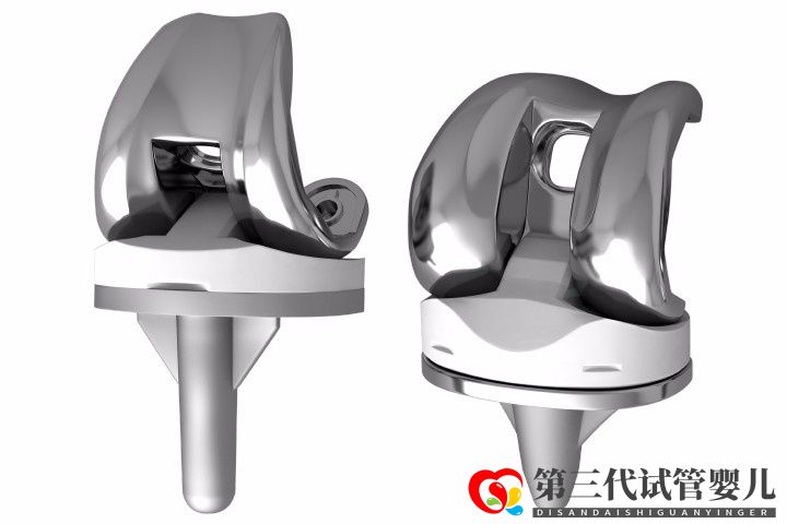人工膝關(guān)節(jié)置換手術(shù)成功率大嗎？膝關(guān)節(jié)置換手術(shù)成功率有多高？(圖1)