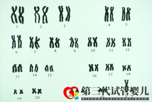 夫妻染色體正常，試管胚胎染色體異常的三個(gè)原因你都知道嗎？(圖1)
