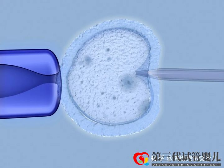試管嬰兒1代、2代、3代、4代哪個最好真實操作過...(圖12)