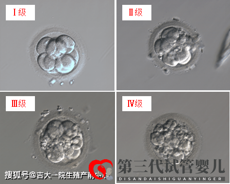 胚胎能看出來男女嗎？(圖1)