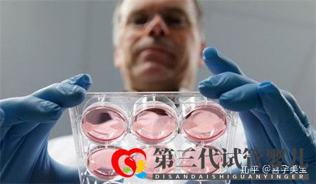 掌控這三點,高齡女性做試管嬰兒成功率將達100%(圖4) 掌控這三點,高齡女性做試管嬰兒成功率將達100%(圖4)