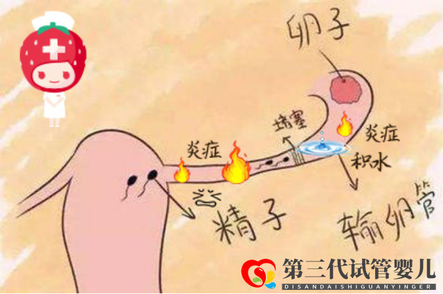 報(bào)喜萬家！輸卵管積水的她放棄做試管，卻憑一劑中藥喜獲“好孕”(圖1)