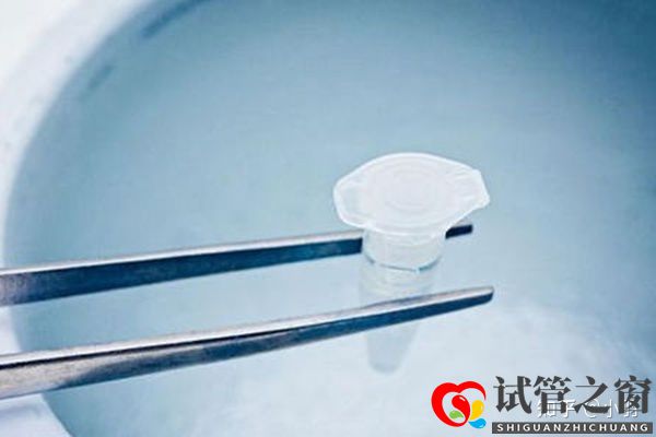 一文帶你了解試管嬰兒整個流程個各個環(huán)節(jié)時間節(jié)點的...(圖3)