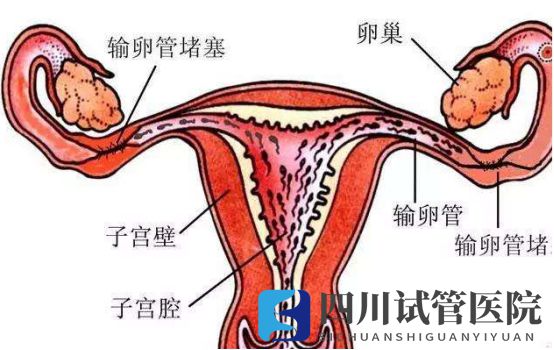 成都兩側(cè)輸卵管堵塞想要孩子，聽說試管嬰兒是最好的選擇(圖1)