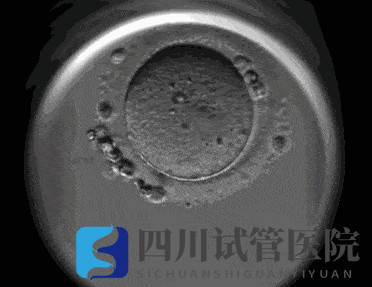 成都試管嬰兒醫(yī)院引進“時差培養(yǎng)箱”，助力篩選更具發(fā)育潛力的胚胎(圖2)