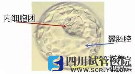 試管嬰兒選取移植胚胎的標準是什么(圖4)