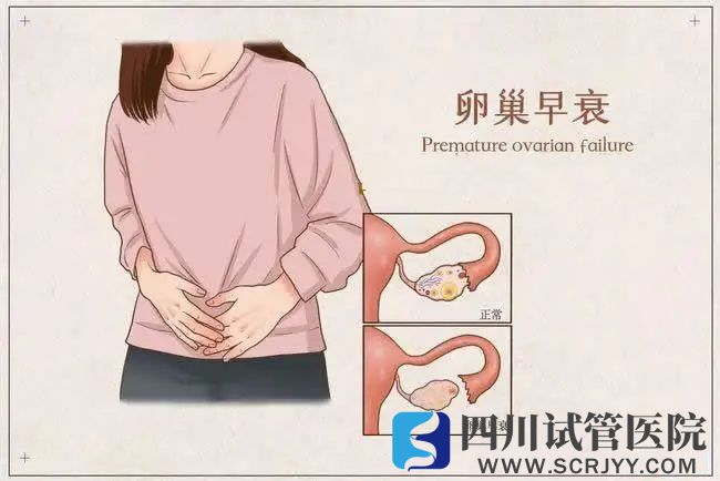 5個(gè)信號暗示卵巢早衰(圖1)