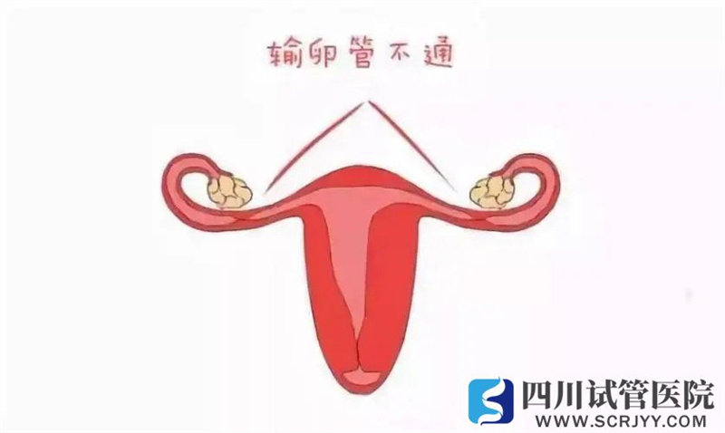 輸卵管的這兩項(xiàng)功能對(duì)懷孕至關(guān)重要，怎么知道它好不好？(圖1)