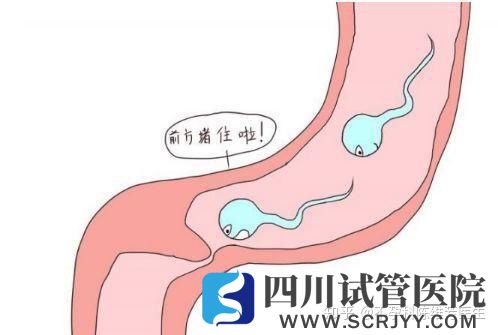 輸卵管如果不通,精子和卵子只能遙遙相對(圖1)