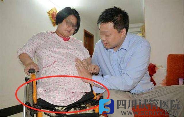 “無腿”媽媽試管生下雙胞胎，如今5年過去，一家人現(xiàn)狀如何？(圖1)