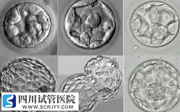 家族遺傳會(huì)讓囊胚分裂成雙胞胎