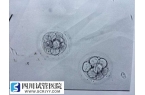 做試管嬰兒一次移植多個(gè)襄胚有好處嗎？